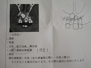 e0120357_126228.jpg