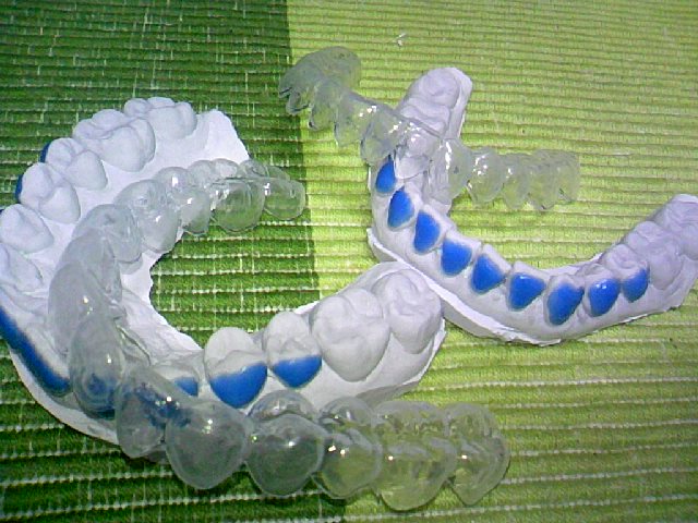 a0167335_21343071.jpg