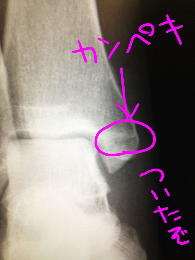 c0198263_20381816.jpg