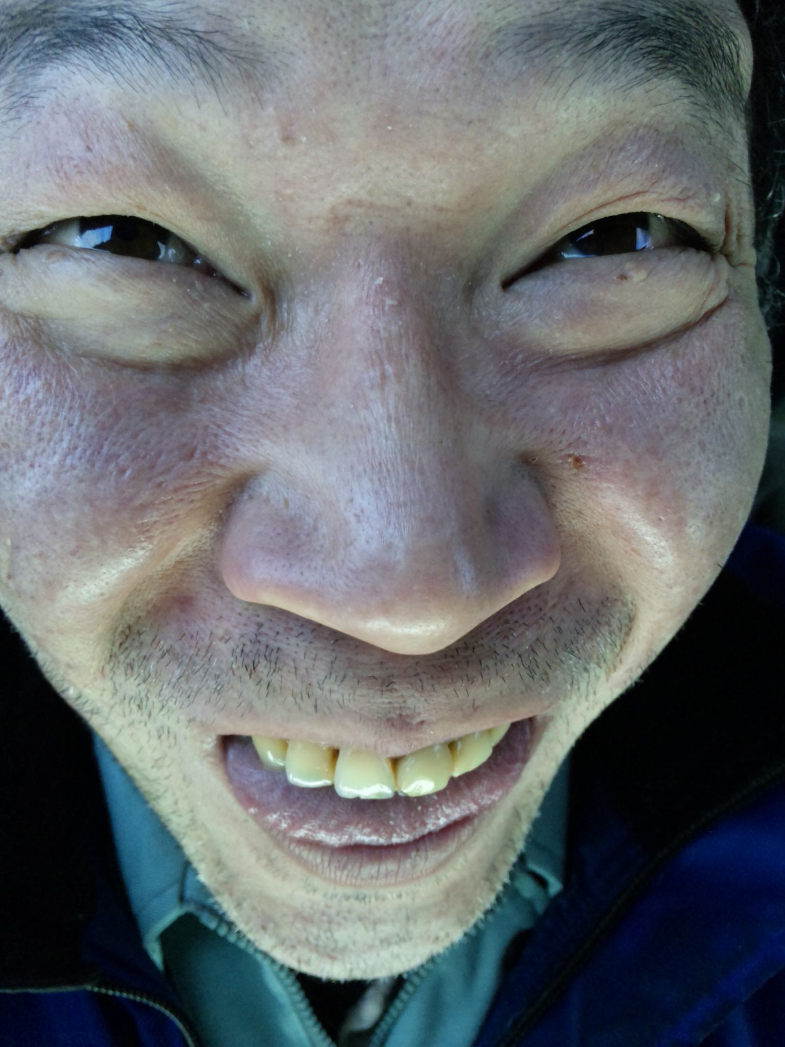 b0199097_184457100.jpg