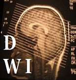 e0156318_1528968.jpg