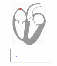 b0112009_20377.gif