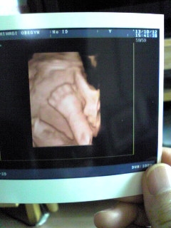 e0113475_1514370.jpg