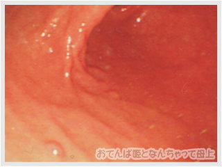 b0026388_8462473.jpg