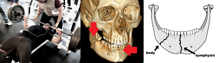 b0112009_1593127.png