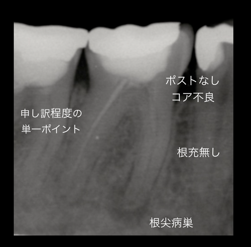 e0004468_14593858.png