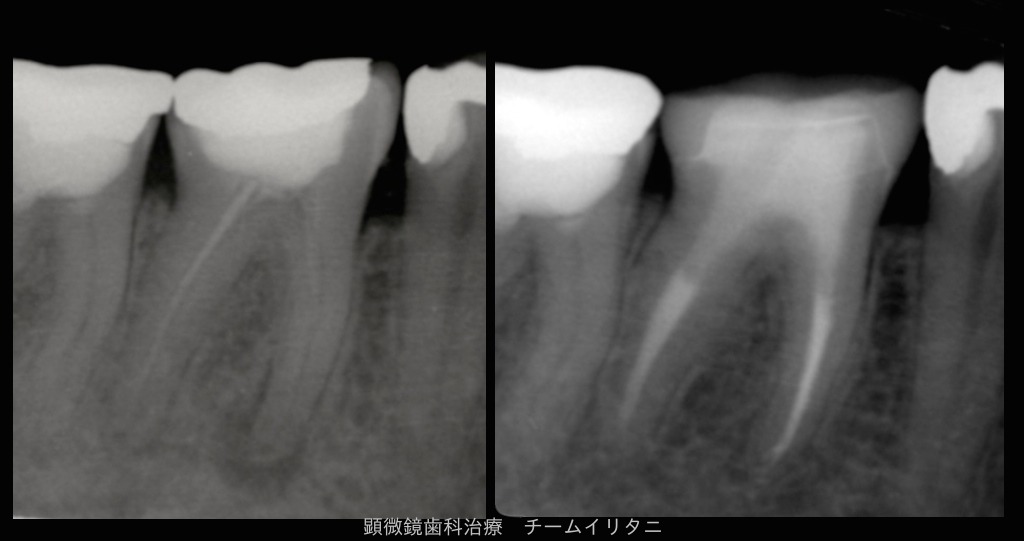 e0004468_9114183.jpg