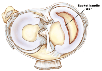 b0112009_6232153.gif