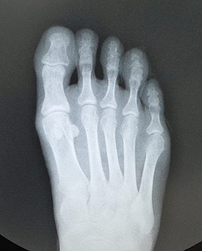 f0036716_13573394.jpg