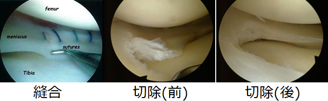 b0112009_7292967.png