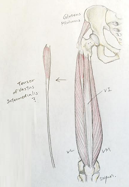 b0112009_234437.png