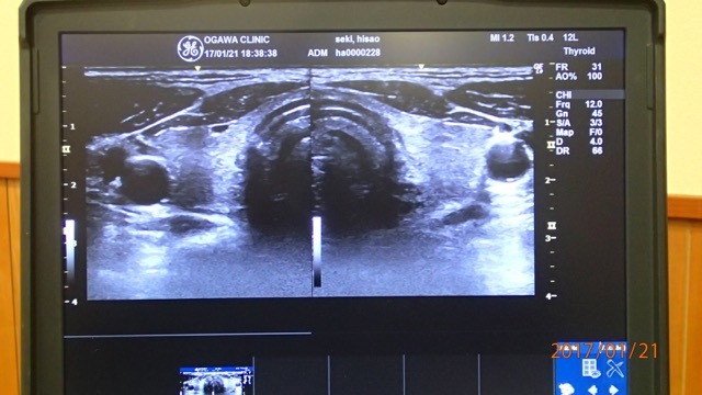 d0320318_11454418.jpg