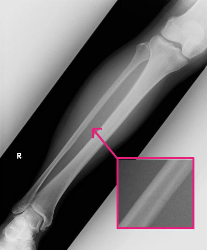 d0107938_172923100.jpg