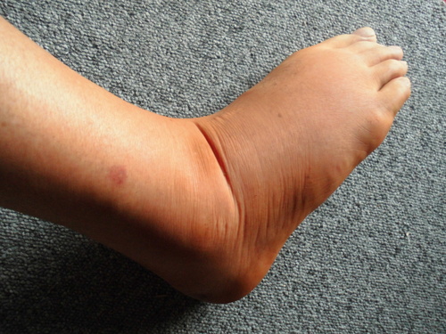 c0108198_15595034.jpg