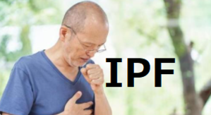偶発的に診断されたIPFの生存期間 - 呼吸器内科医