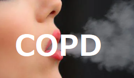 RESTORE試験事後解析：COPD増悪・QOLに対するエルドステイン - 呼吸器内科医