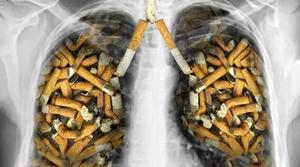 Quitting smoking early linked to better survival rates in lung cancer patients - 