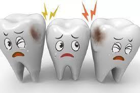 Understanding Molar Teeth: Their Function and Importance - 