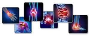 Arthritis & Joint Pain Relief - Effective Treatments - 