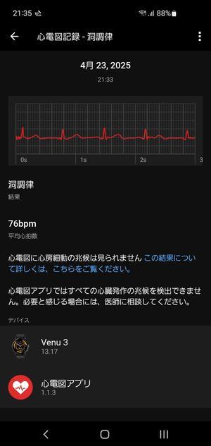 250615 GARMIN Venu 3 の心電図アプリを使ってみた - 100日記