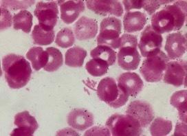 血液培養におけるグラム陰性菌の見方、考え方  2025年6月  およびPseudomonas oryzihabitans 2025 感受性結果はone healthより - Sakai-infections