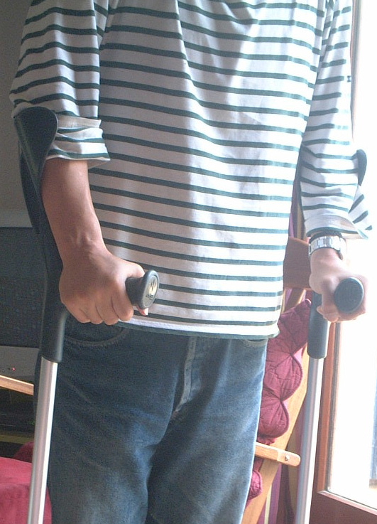 捻挫(ねんざ)・・・_a0008105_5285543.jpg