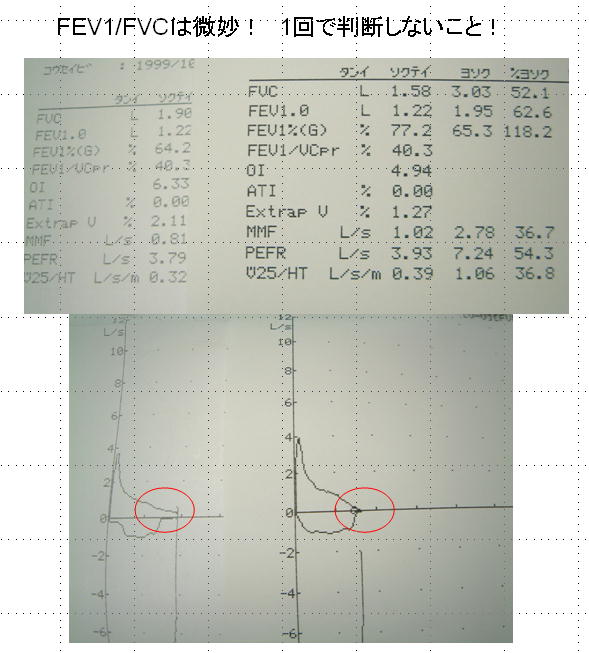 たかが・・・1秒率 されど1秒率・・・_a0007242_15483574.jpg