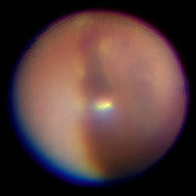 イヤワックス_e0082981_222975.jpg
