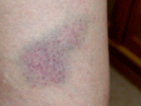 e0054499_15315679.gif