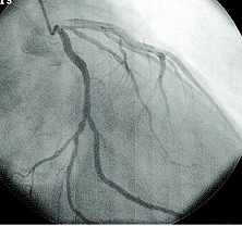 心臓、冠動脈、検査のこと_a0055913_1423854.jpg