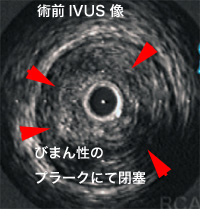 a0055913_8292279.jpg