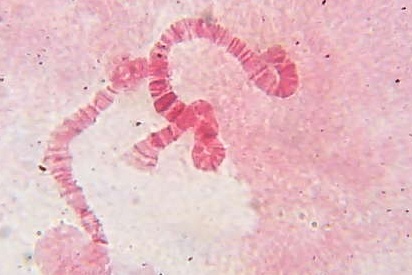 教室にて その4 唾液腺染色体の観察 福泉亮のビレイ オンbelayon 教室にて その4 唾液腺染色体の観察 福泉亮のビレイ オンbelayon