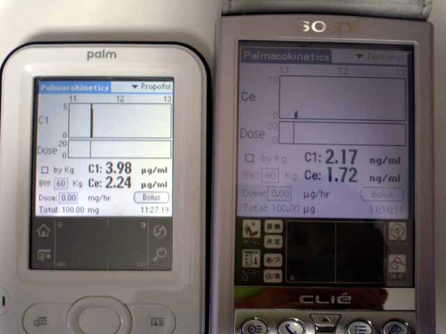 Palm Z22使用記　2_a0048974_22411056.jpg