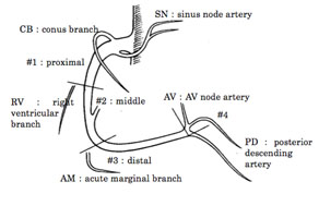 冠動脈の分類について　ー右冠動脈ー_a0055913_2021745.jpg