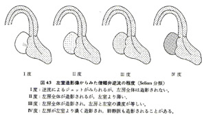 心機能の評価_a0055913_1134434.jpg