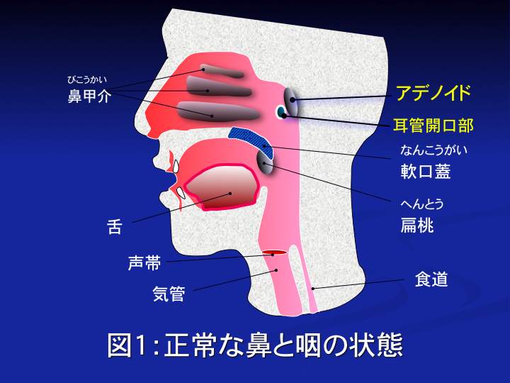 アデノイド : あさひ町榊原耳鼻咽喉科 院長のブログ