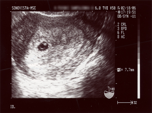 推定5w1d おかえりベイビー Come Baby Come 推定5w1d おかえりベイビー Come Baby Come