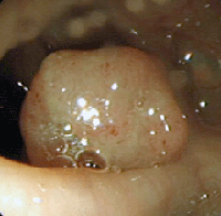 a0055913_12313195.gif