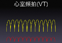 a0055913_1248160.gif