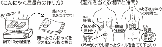 こんにゃく湿布（ていうか、お灸）_a0012690_20295683.gif