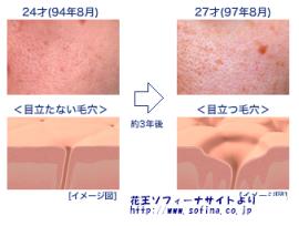 2年目 大人の毛穴ケア 化粧品屋のひそひそ話