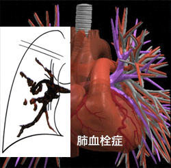 a0055913_0134919.gif