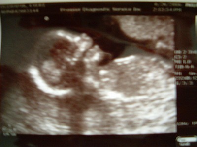 3rd Ultrasound_f0011322_12384088.jpg