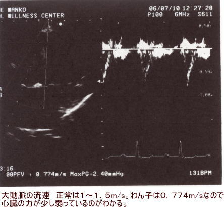 エコー検査_c0048736_1645922.jpg