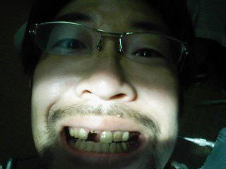 ◆ はぬけはまぬけ ◆_a0033733_19321714.jpg