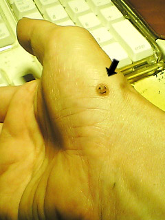 人面瘡 さとうさとお の チンタラ日記