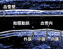 a0055913_085334.gif