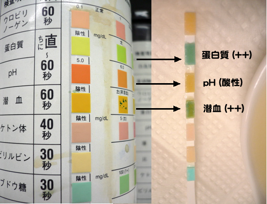 尿検査 ねねふくのヒミツ