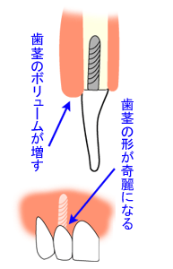 抜糸　（治療3３回目）　11月14日（火） 　その１_e0074634_1832315.gif