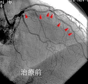 だんだん仕事が忙しくなってきました．_a0055913_23495611.gif